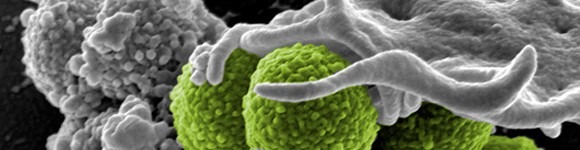 Mantener Libres de Gérmenes y Bacterias Bayetas y Estropajos
